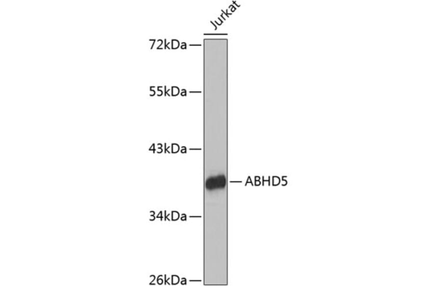 Western Blot - Anti-Abhd5/CGI-58 Antibody (A89691) - Antibodies.com