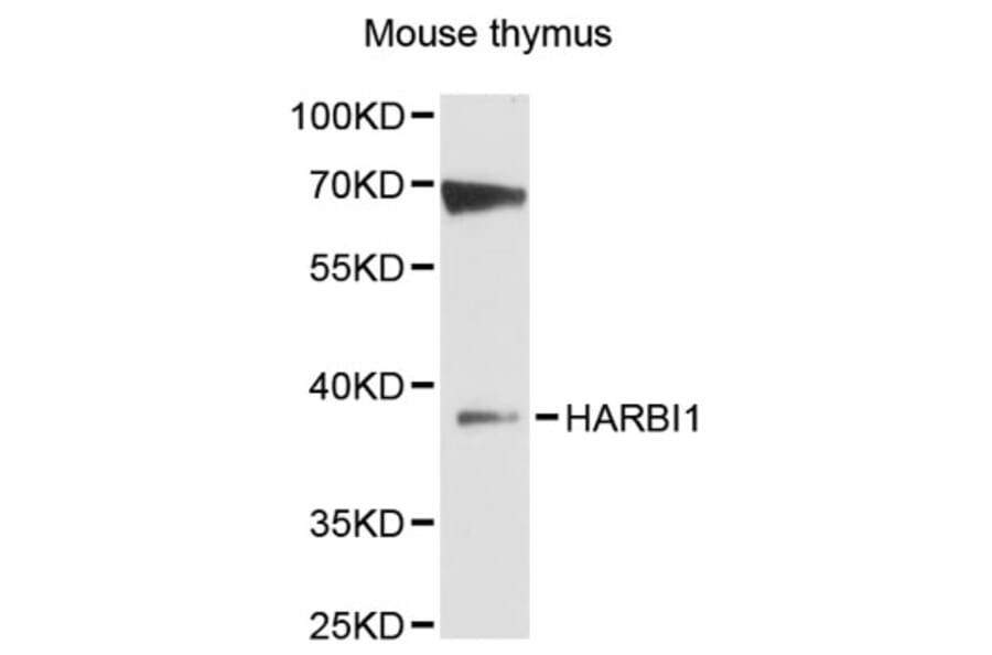 Western Blot - Anti-HARBI1 Antibody (A12869) - Antibodies.com