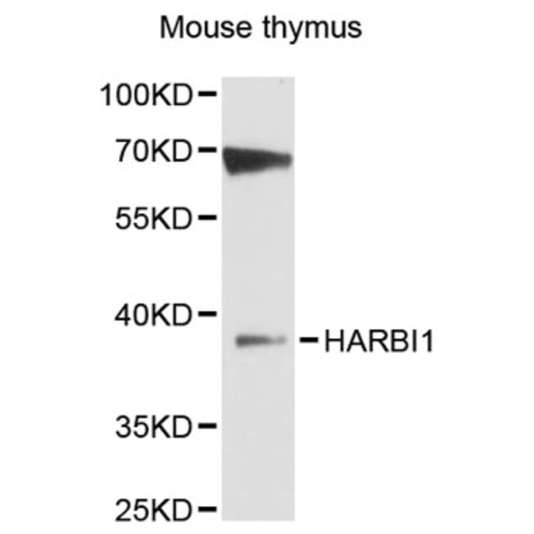Western Blot - Anti-HARBI1 Antibody (A12869) - Antibodies.com