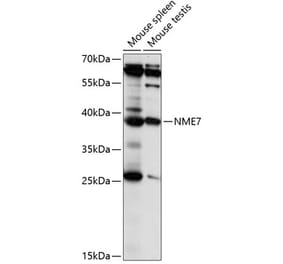 Western Blot - Anti-Nucleoside Diphosphate Kinase 7 Antibody (A89693) - Antibodies.com
