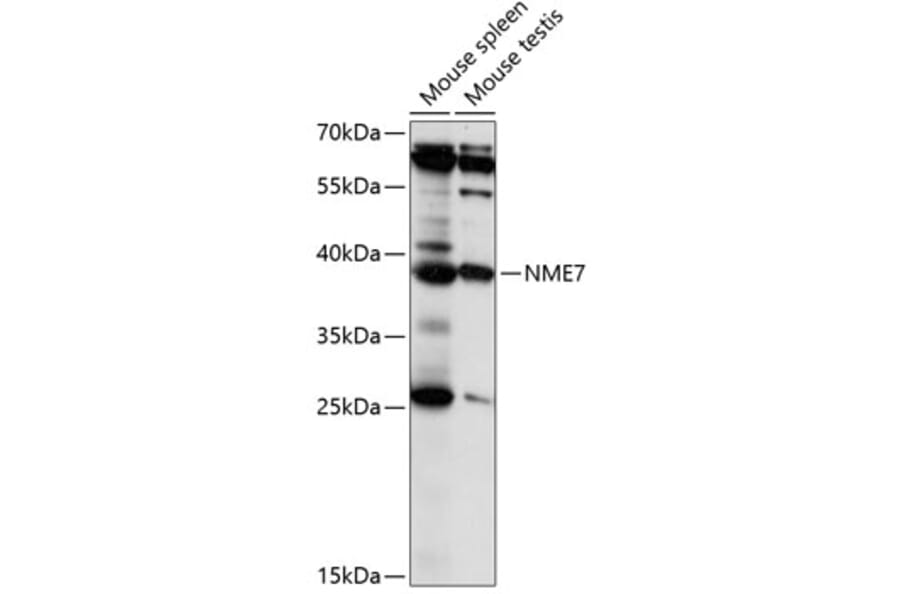 Western Blot - Anti-Nucleoside Diphosphate Kinase 7 Antibody (A89693) - Antibodies.com