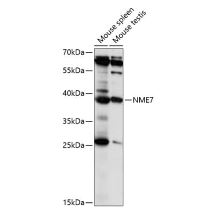 Western Blot - Anti-Nucleoside Diphosphate Kinase 7 Antibody (A89693) - Antibodies.com