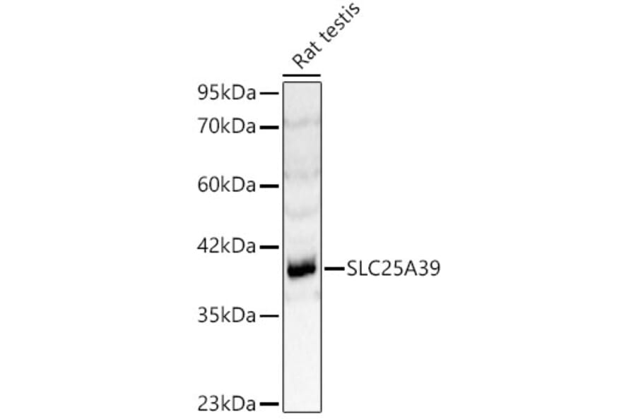 Western Blot - Anti-SLC25A39 Antibody (A89694) - Antibodies.com