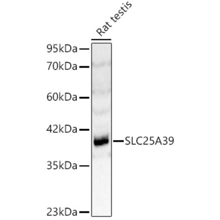 Western Blot - Anti-SLC25A39 Antibody (A89694) - Antibodies.com