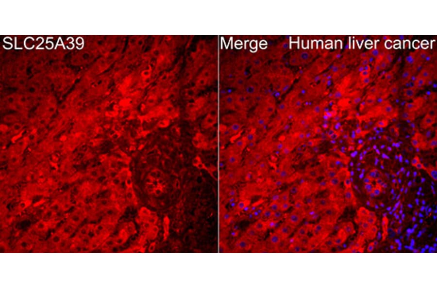 Immunofluorescence - Anti-SLC25A39 Antibody (A89694) - Antibodies.com
