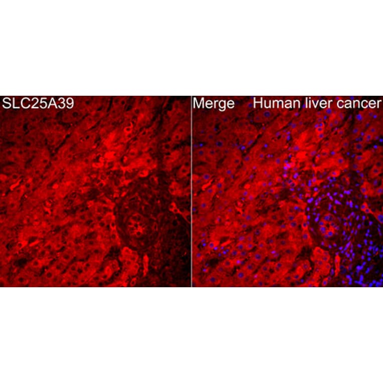 Immunofluorescence - Anti-SLC25A39 Antibody (A89694) - Antibodies.com
