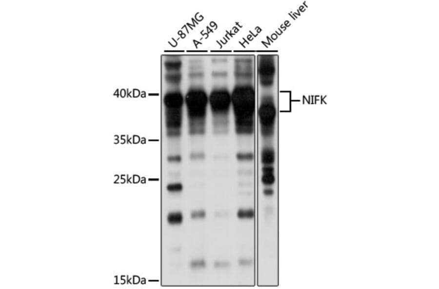 Western Blot - Anti-NIFK Antibody (A89695) - Antibodies.com