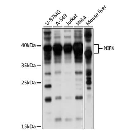 Western Blot - Anti-NIFK Antibody (A89695) - Antibodies.com