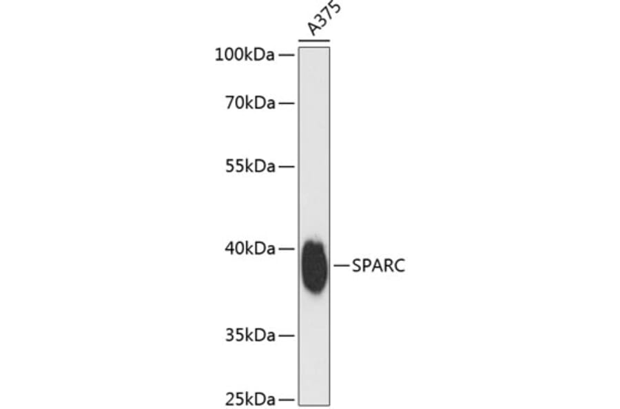 Western Blot - Anti-SPARC Antibody (A89696) - Antibodies.com
