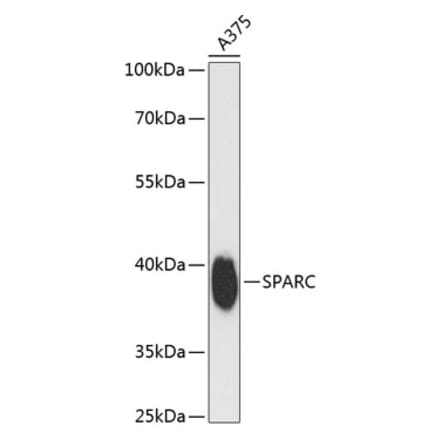 Western Blot - Anti-SPARC Antibody (A89696) - Antibodies.com