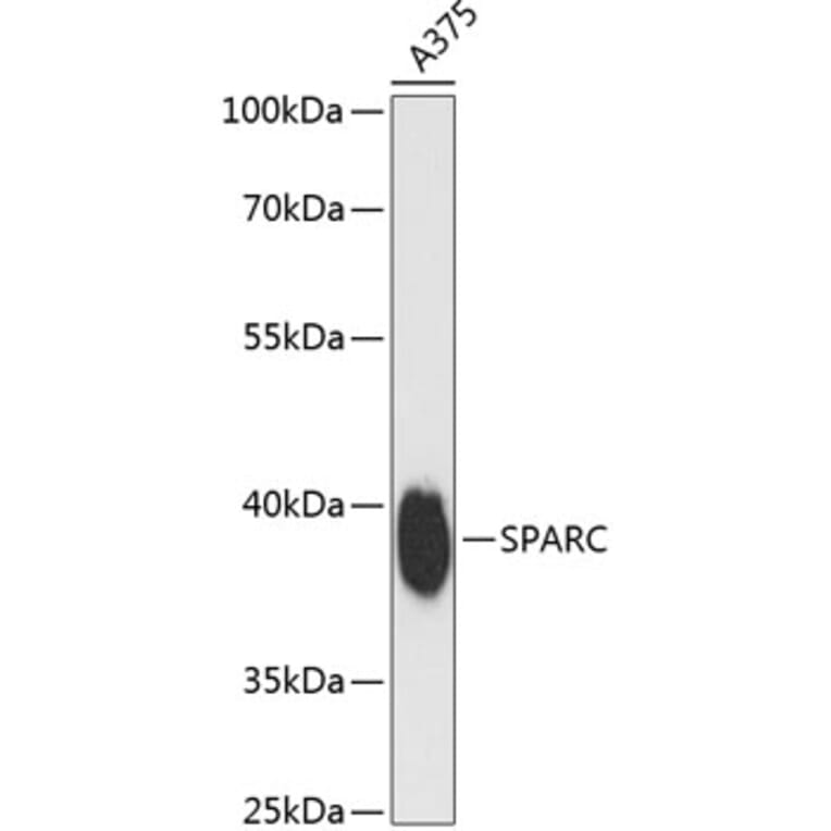 Western Blot - Anti-SPARC Antibody (A89696) - Antibodies.com