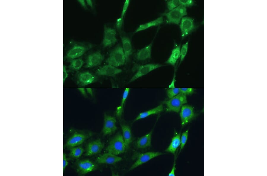 Immunofluorescence - Anti-SPARC Antibody (A89696) - Antibodies.com