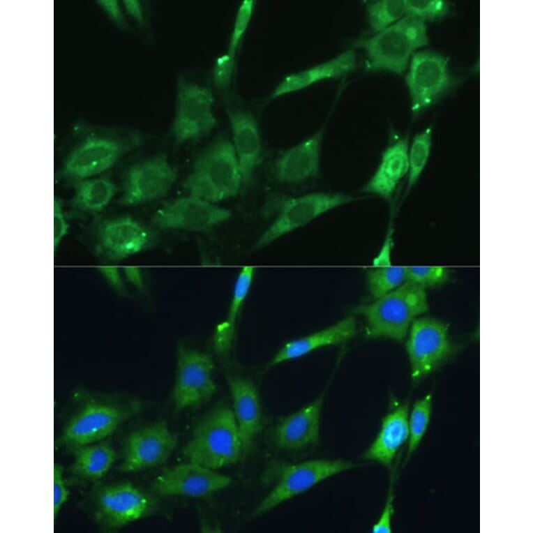 Immunofluorescence - Anti-SPARC Antibody (A89696) - Antibodies.com