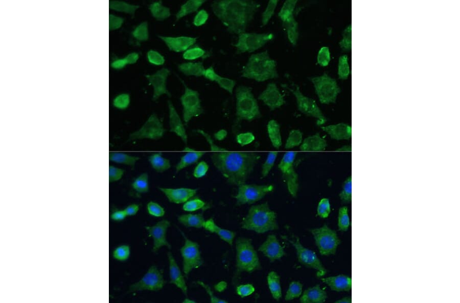 Immunofluorescence - Anti-SPARC Antibody (A89696) - Antibodies.com