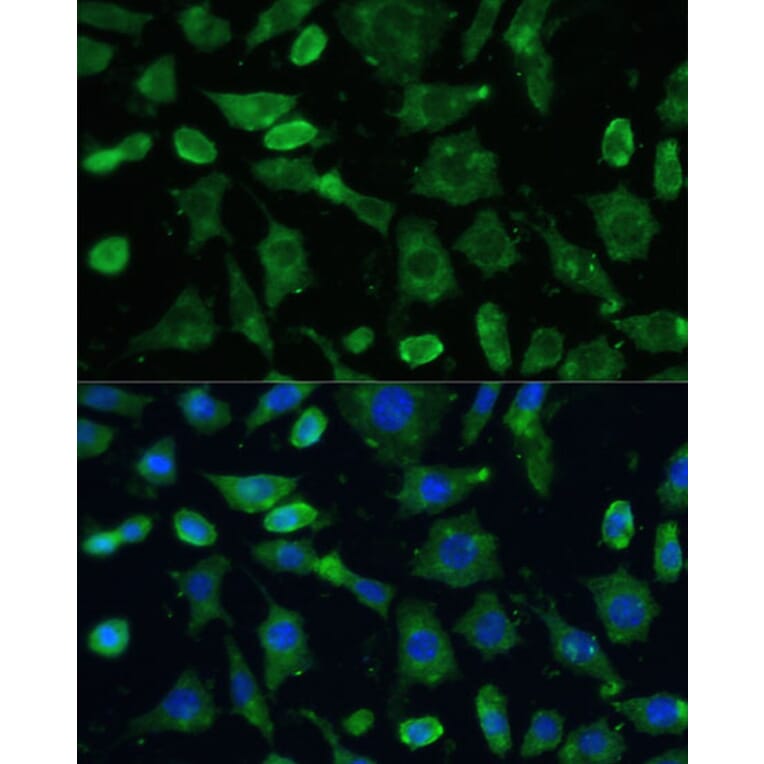 Immunofluorescence - Anti-SPARC Antibody (A89696) - Antibodies.com