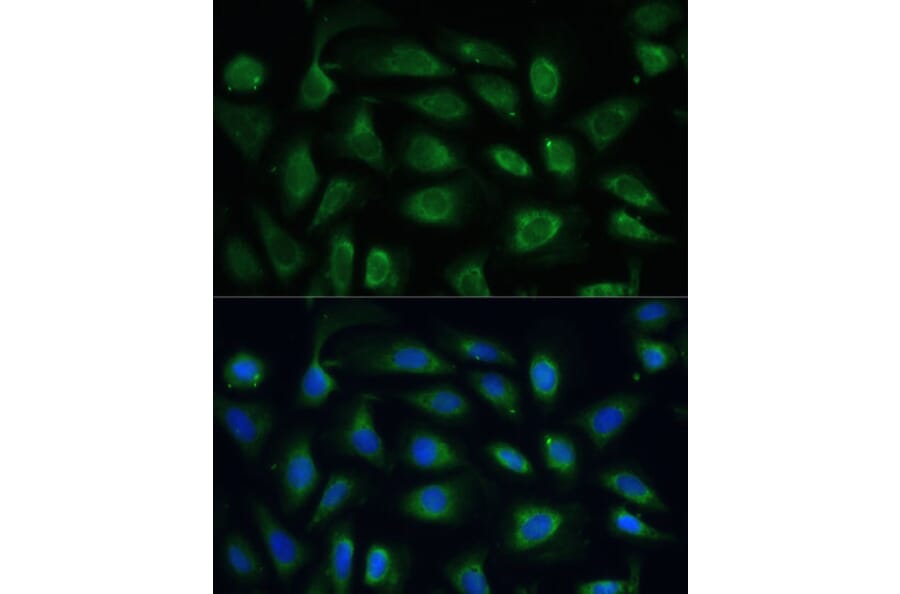 Immunofluorescence - Anti-SPARC Antibody (A89696) - Antibodies.com