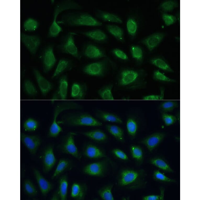 Immunofluorescence - Anti-SPARC Antibody (A89696) - Antibodies.com