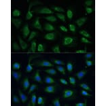 Immunofluorescence - Anti-SPARC Antibody (A89696) - Antibodies.com