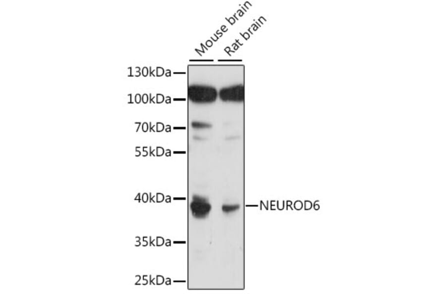 Western Blot - Anti-MATH2/NEUROD6 Antibody (A89697) - Antibodies.com