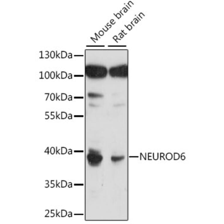Western Blot - Anti-MATH2/NEUROD6 Antibody (A89697) - Antibodies.com
