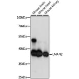 Western Blot - Anti-VIP36 Antibody (A89698) - Antibodies.com