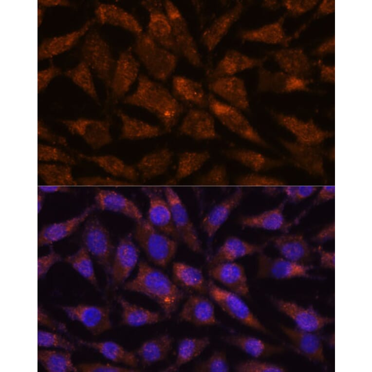 Immunofluorescence - Anti-VIP36 Antibody (A89698) - Antibodies.com
