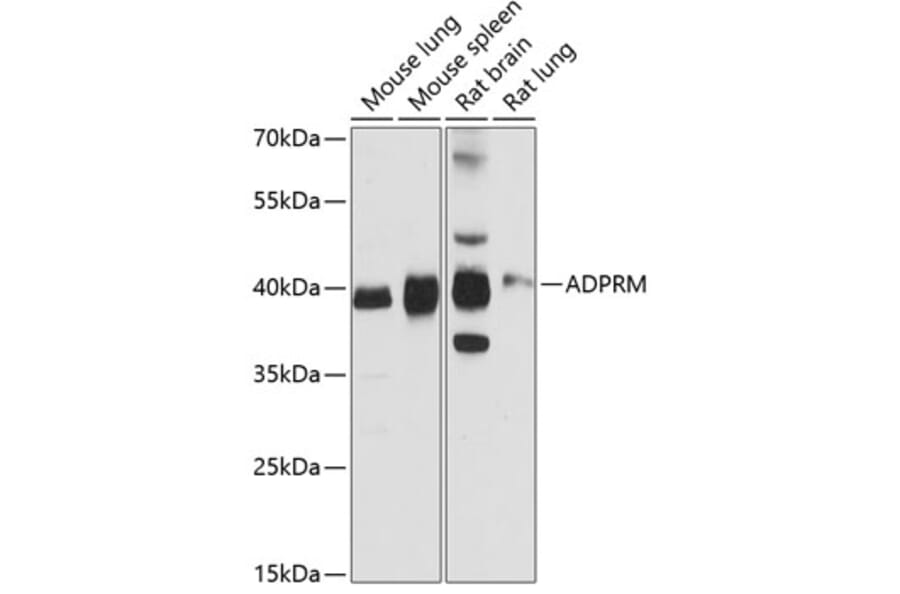 Western Blot - Anti-ADPRM Antibody (A89699) - Antibodies.com