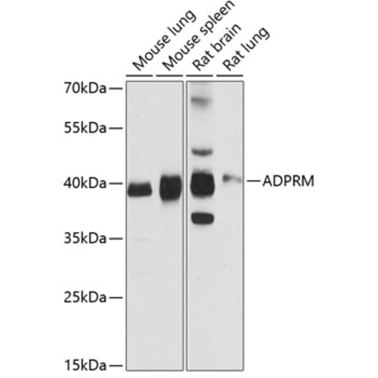 Western Blot - Anti-ADPRM Antibody (A89699) - Antibodies.com