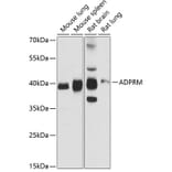 Western Blot - Anti-ADPRM Antibody (A89699) - Antibodies.com