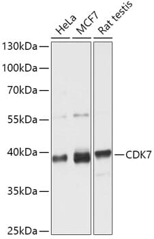 Anti-CDK7 (phospho Thr170) Antibody (A94085) | Antibodies.com