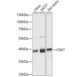 Western Blot - Anti-Cdk7 Antibody (A89700) - Antibodies.com