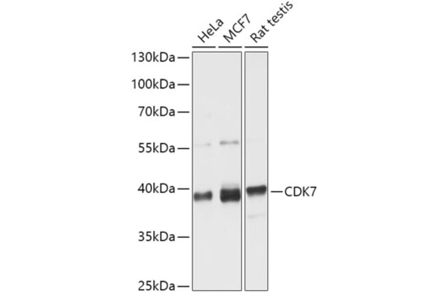 Western Blot - Anti-Cdk7 Antibody (A89700) - Antibodies.com