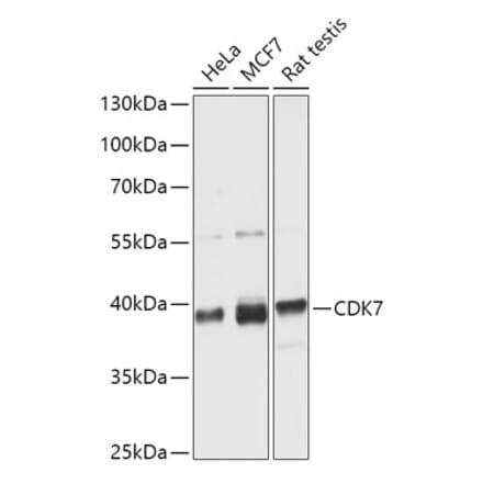 Western Blot - Anti-Cdk7 Antibody (A89700) - Antibodies.com