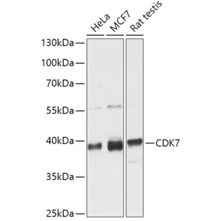 Western Blot - Anti-Cdk7 Antibody (A89700) - Antibodies.com