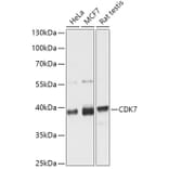 Western Blot - Anti-Cdk7 Antibody (A89700) - Antibodies.com