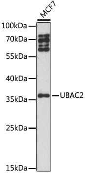 Western blot analysis of extracts of MCF7 cells, using Anti-UBAC2 Antibody (A15975) at 1:1,000 dilution.
Secondary antibody: Goat Anti-Rabbit IgG (H+L) (HRP) (AS014) at 1:10,000 dilution.
Lysates / proteins: 25µg per lane.
Blocking buffer: 3% non-fat dry milk in TBST.
Detection: ECL Basic Kit (RM00020).
Exposure time: 90s.