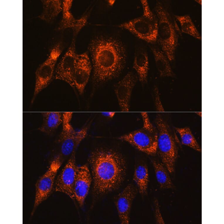 Immunofluorescence - Anti-UBAC2 Antibody (A89701) - Antibodies.com