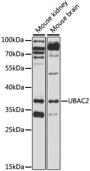 Western blot analysis of extracts of various cell lines, using Anti-UBAC2 Antibody (A15977) at 1:1,000 dilution.
Secondary antibody: Goat Anti-Rabbit IgG (H+L) (HRP) (AS014) at 1:10,000 dilution.
Lysates / proteins: 25µg per lane.
Blocking buffer: 3% non-fat dry milk in TBST.
Detection: ECL Enhanced Kit (RM00021).
Exposure time: 90s.