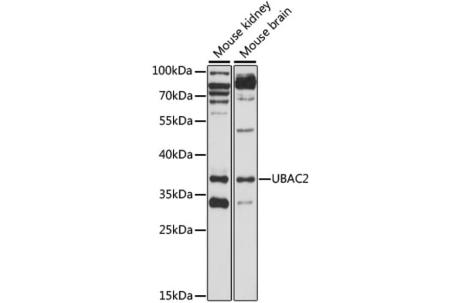 Western Blot - Anti-UBAC2 Antibody (A89702) - Antibodies.com