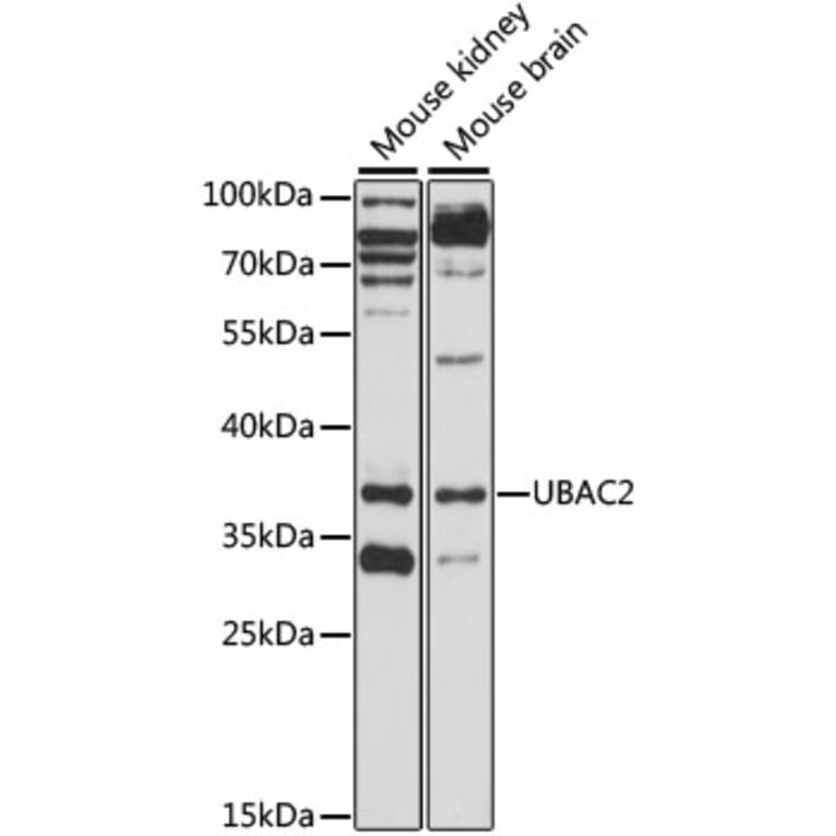 Western Blot - Anti-UBAC2 Antibody (A89702) - Antibodies.com