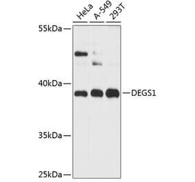 Western Blot - Anti-MLD Antibody (A89704) - Antibodies.com