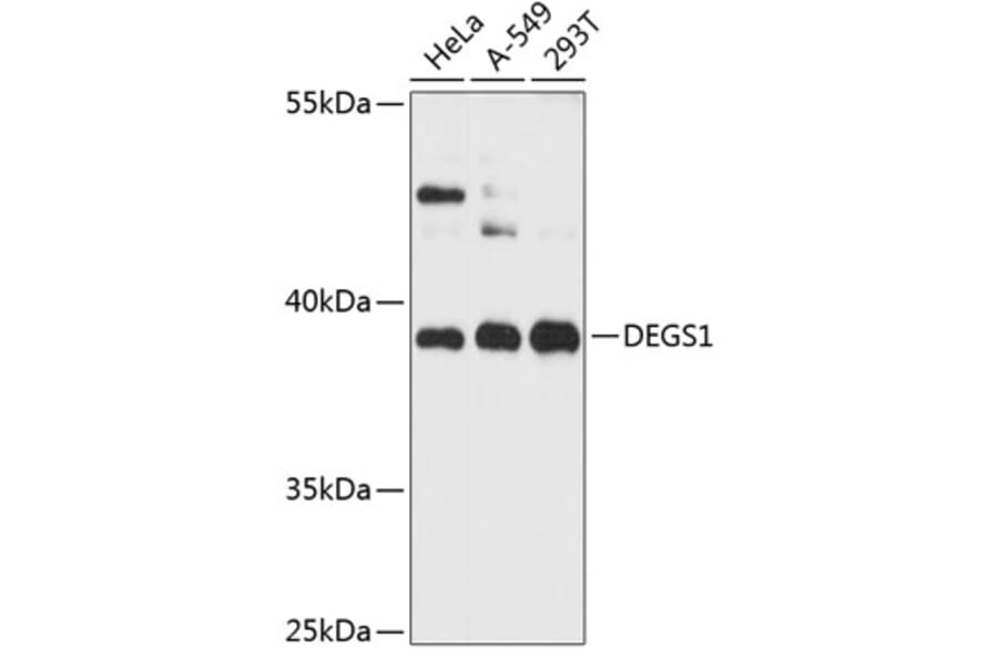 Western Blot - Anti-MLD Antibody (A89704) - Antibodies.com