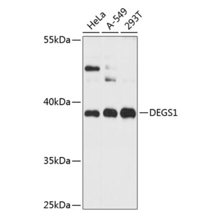 Western Blot - Anti-MLD Antibody (A89704) - Antibodies.com