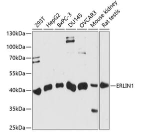 Western Blot - Anti-ERLIN1 Antibody (A89706) - Antibodies.com
