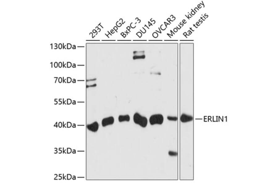 Western Blot - Anti-ERLIN1 Antibody (A89706) - Antibodies.com