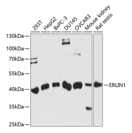 Western Blot - Anti-ERLIN1 Antibody (A89706) - Antibodies.com