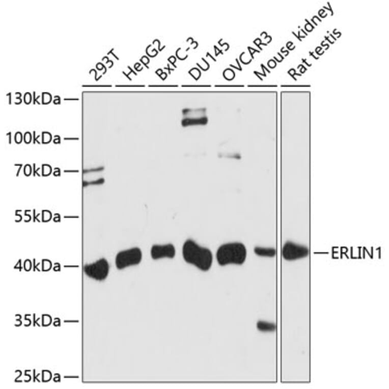 Western Blot - Anti-ERLIN1 Antibody (A89706) - Antibodies.com
