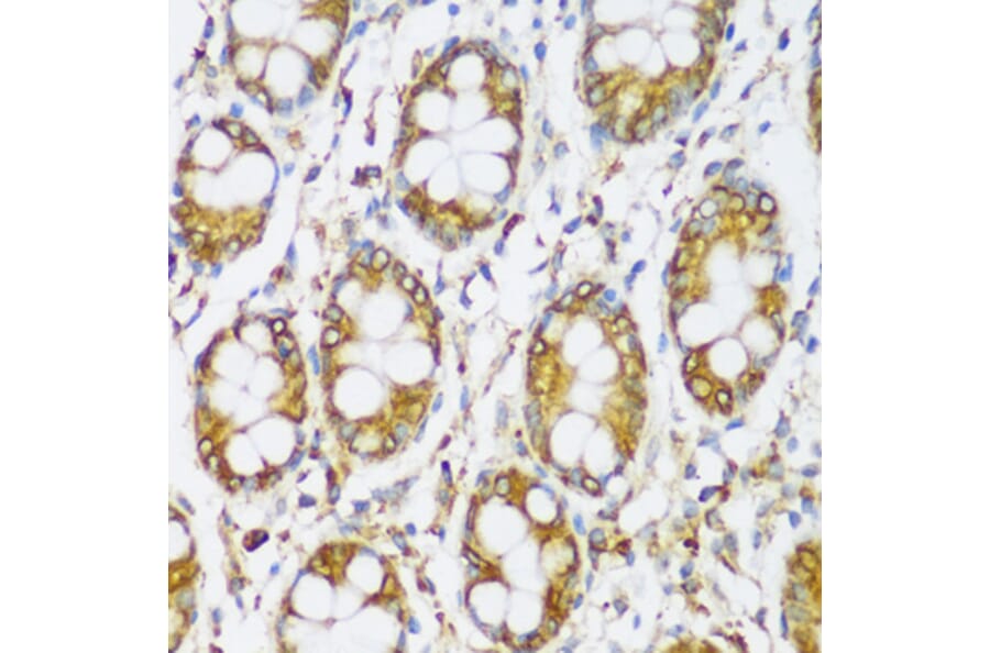Immunohistochemistry - Anti-ERLIN1 Antibody (A89706) - Antibodies.com