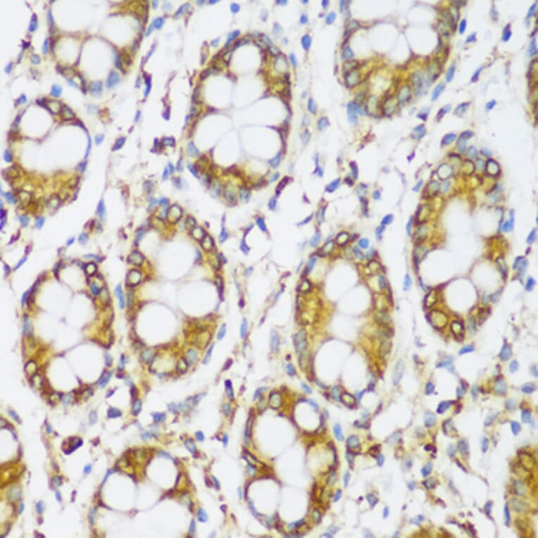 Immunohistochemistry - Anti-ERLIN1 Antibody (A89706) - Antibodies.com