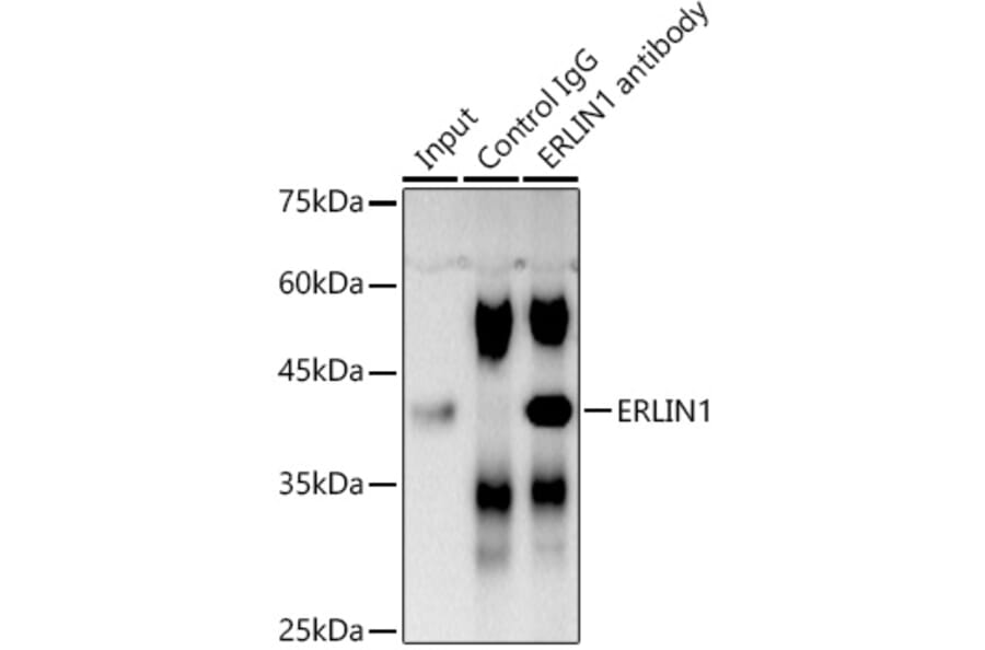 Western Blot - Anti-ERLIN1 Antibody (A89706) - Antibodies.com